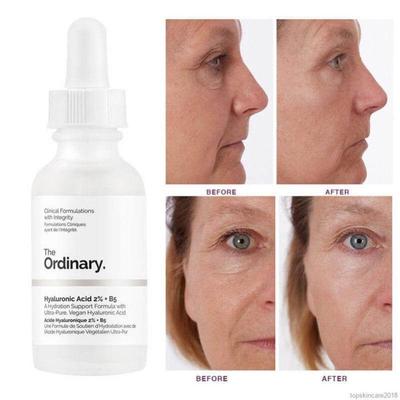 Hydrating Anti-Aging Hyaluronic Acid Serum 30ml – For Even Skin Tone & Radiant Glow